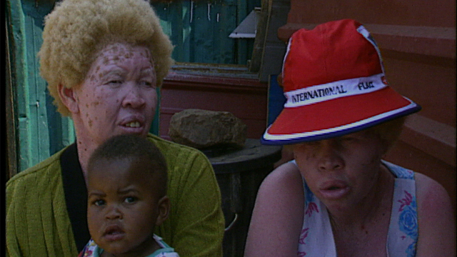 Black Albinos Black Albinos